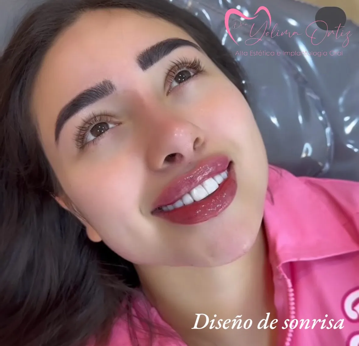 Diseño de Sonrisa - Dra. Yolima Ortiz
