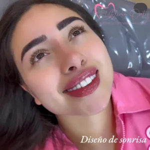 Diseño de Sonrisa - Dra. Yolima Ortiz (2)